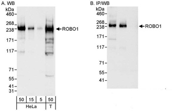 Rabbit ROBO1 Antibody