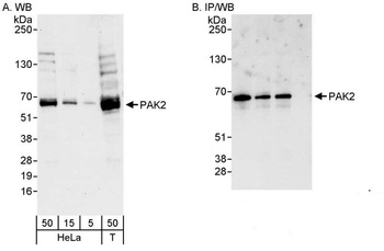 Rabbit anti-PAK2 Antibody
