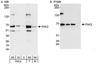 Rabbit anti-PAK2 Antibody