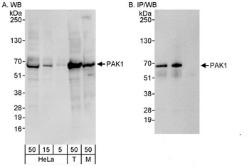 Rabbit anti-PAK1 Antibody