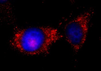 Rabbit ILK Antibody