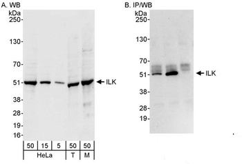 Rabbit ILK Antibody
