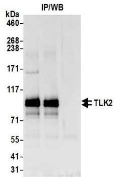 Rabbit anti-TLK2 Antibody