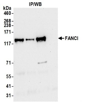 FANCI Antibody