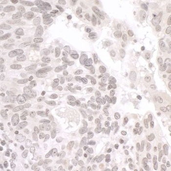 PALB2 Antibody