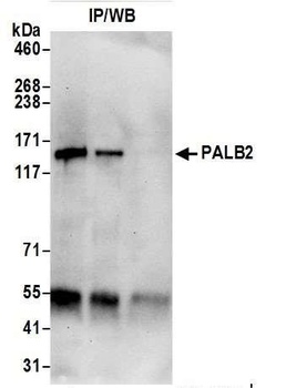 Rabbit anti-PALB2 Antibody