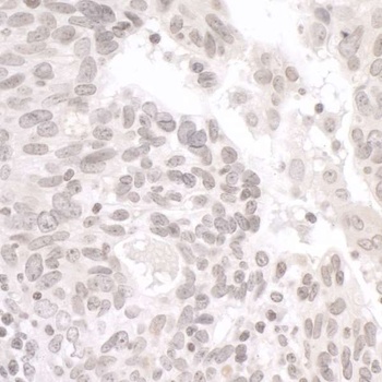 Rabbit anti-PALB2 Antibody