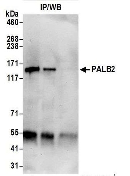 PALB2 Antibody