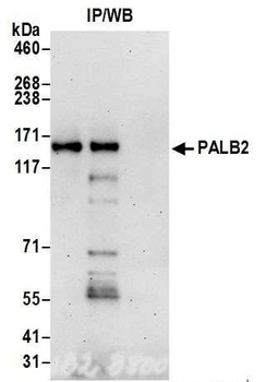 Rabbit anti-PALB2 Antibody
