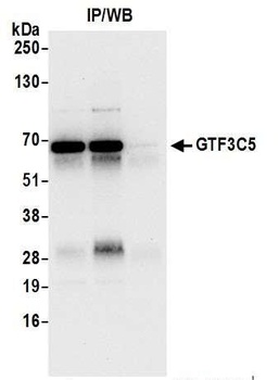 GTF3C5/TFIIIC63 Antibody