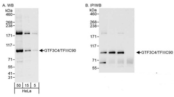 Rabbit anti-GTF3C4/TFIIIC90 Antibody