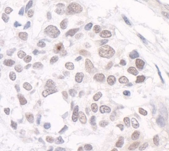 Rabbit anti-GTF3C3/TFIIIC102 Antibody