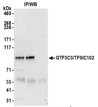 GTF3C3/TFIIIC102 Antibody