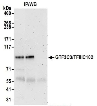 Rabbit anti-GTF3C3/TFIIIC102 Antibody