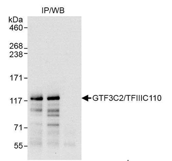 Rabbit anti-GTF3C2/TFIIIC110 Antibody