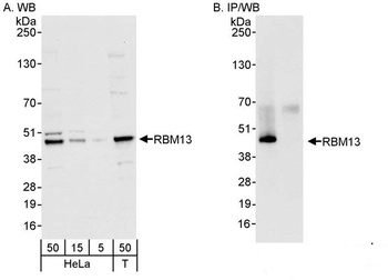 Rabbit RBM13 Antibody