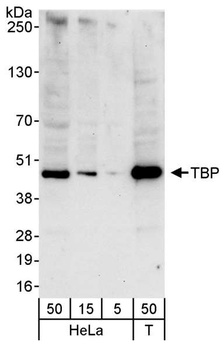 Rabbit TBP Antibody