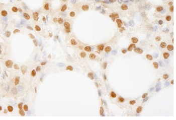 Rabbit anti-BRF1 Antibody