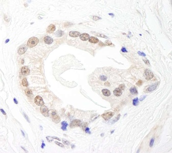 Rabbit BRF1 Antibody