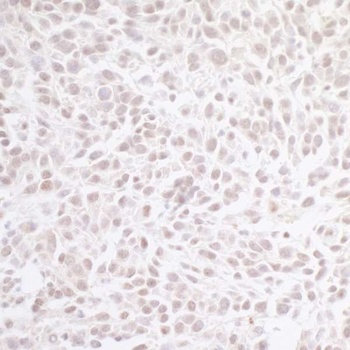 CHD8 Antibody