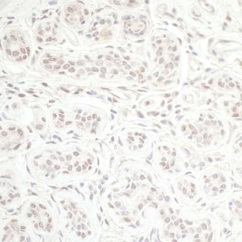 Rabbit anti-CHD8 Antibody