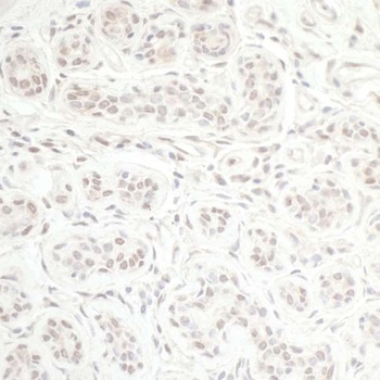 CHD8 Antibody