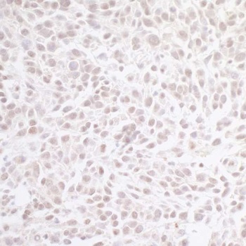 Rabbit anti-CHD8 Antibody