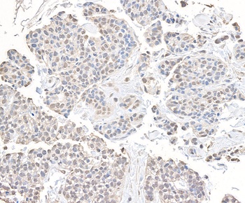 Rabbit anti-CHD8 Antibody