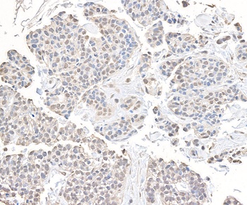 CHD8 Antibody