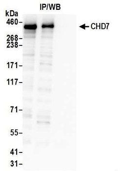 Rabbit anti-CHD7 Antibody