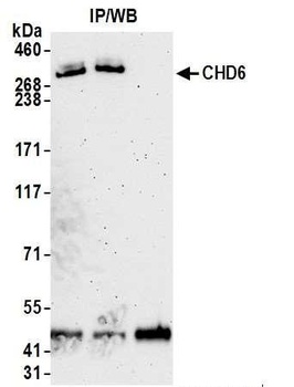 CHD6 Antibody