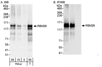 RBM26 Antibody