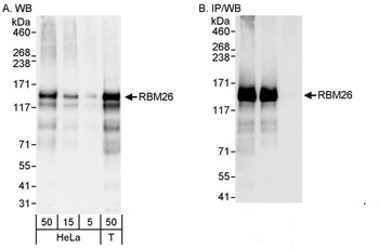 Rabbit anti-RBM26 Antibody