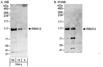 Rabbit anti-RBM12 Antibody