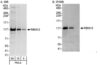 Rabbit anti-RBM12 Antibody