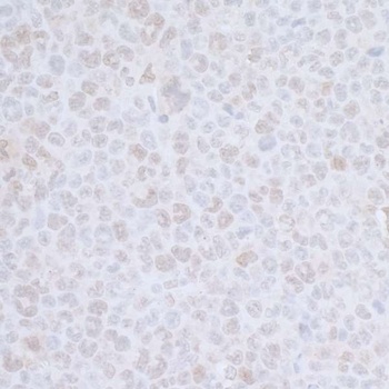Rabbit anti-CDC20 Antibody