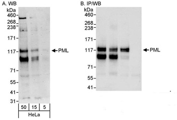 Rabbit anti-PML Antibody