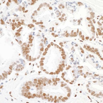 Rabbit anti-PML Antibody