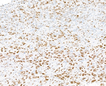 Rabbit anti-PML Antibody