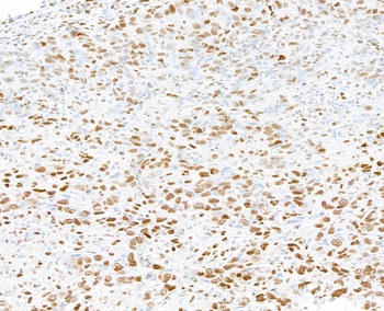 PML Antibody