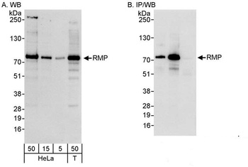 Rabbit RMP Antibody