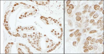 Rabbit PC4 Antibody