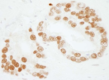 Rabbit PC4 Antibody
