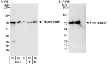 Rabbit TRIM16/EBBP Antibody