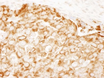 Rabbit IRS1 Antibody