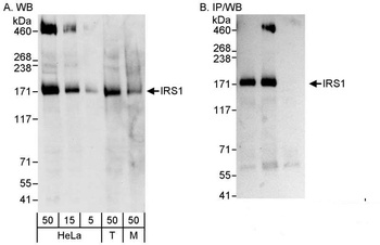 Rabbit IRS1 Antibody