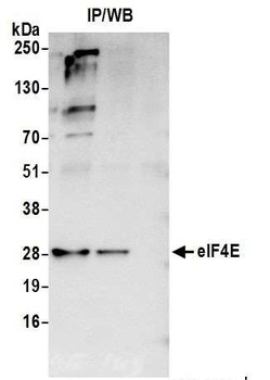 Rabbit eIF4E Antibody