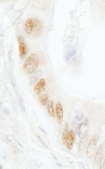 Rabbit DNA Ligase 1 Antibody