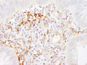 Rabbit Filamin A Antibody