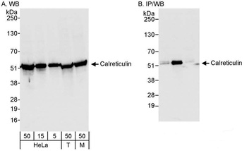 Rabbit Calreticulin Antibody